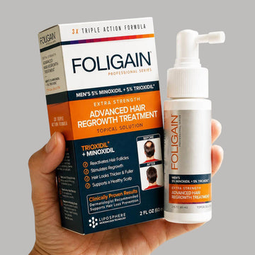 The Benefits of Using Minoxidil with Other Treatments